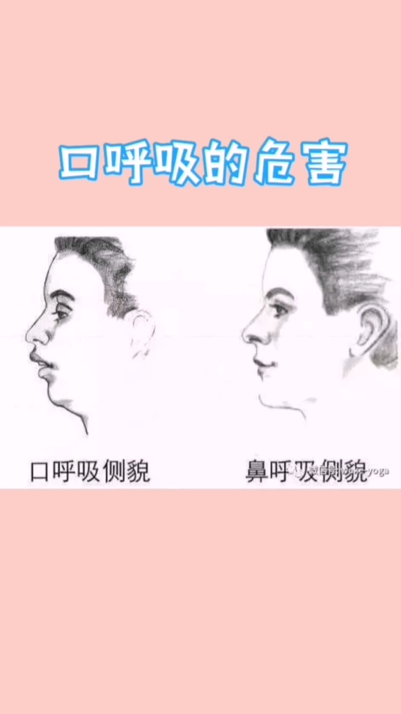 【口呼吸的危害】重要一点忘记说了口呼吸会造成颞下颌关节弹响就是