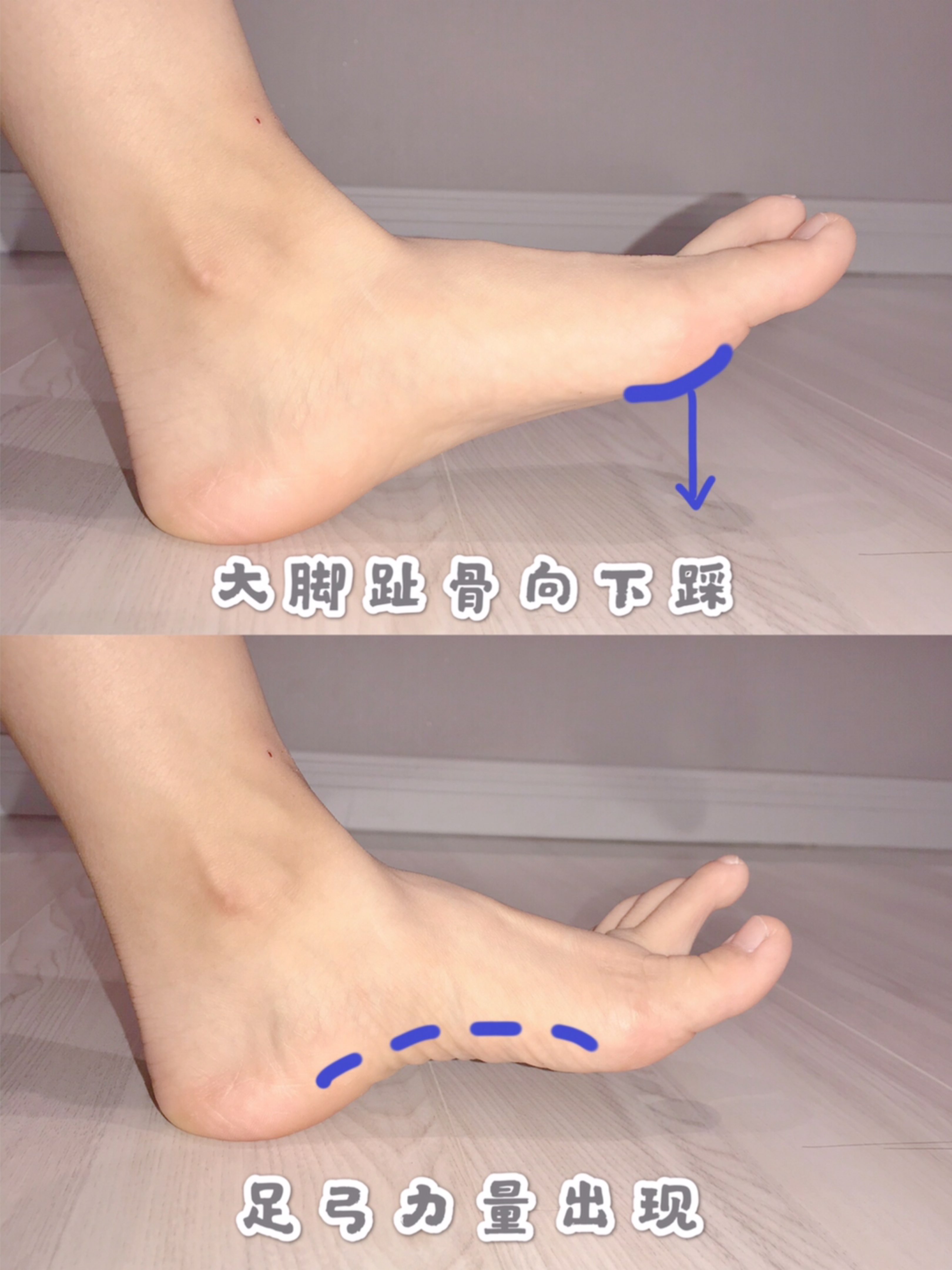 消除xo型腿的武器居然藏在jio底不信的同学现在去镜子面前,让双脚