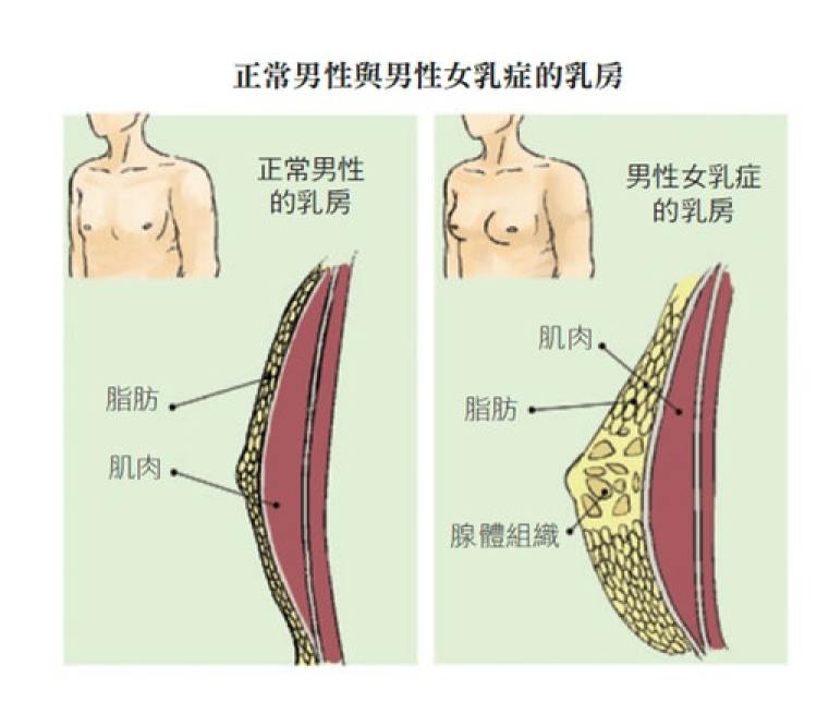 胸部下垂 做这4招 Keep 胸部下垂 做这4招 Keep