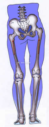 体态矫正 关于长短腿的类型 检测方法与矫正训练 Keep