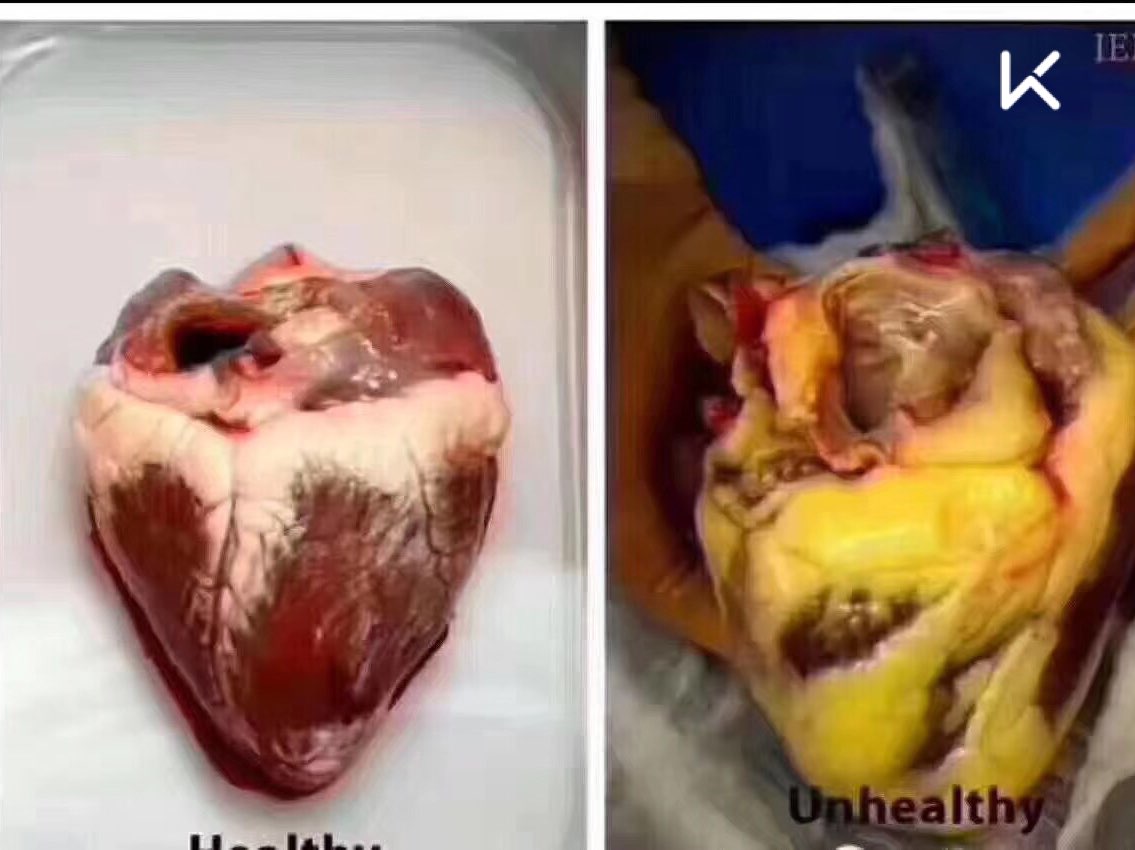 pisces_sa的动态 - keep