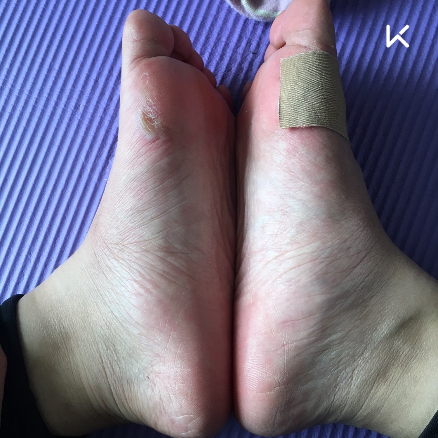 感觉已经是双废脚了