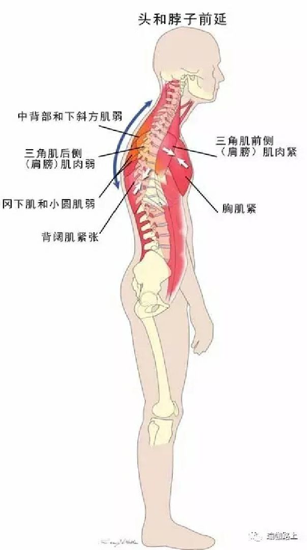 腰疼四大原因我们常说的背痛 通常指的是下背部疼痛 Keep