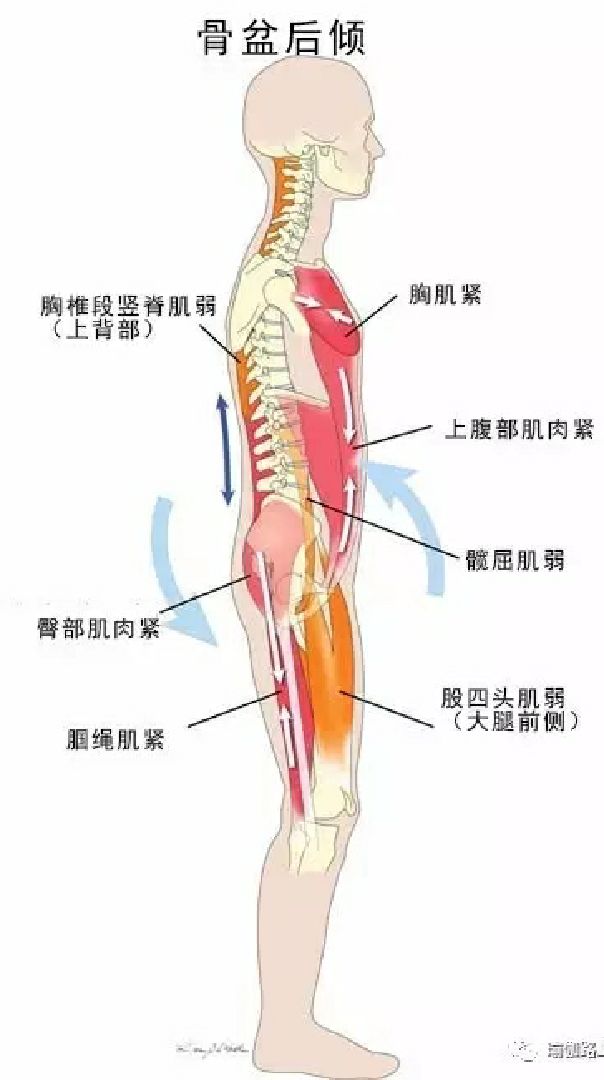 腰疼四大原因我们常说的背痛 通常指的是下背部疼痛 Keep