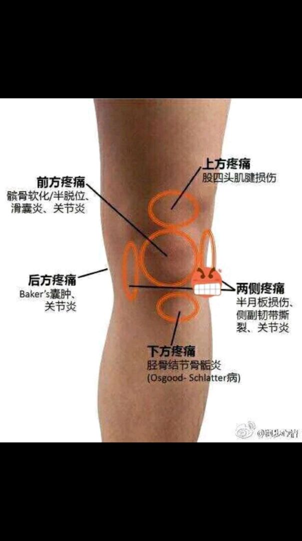 儿童白血病腿疼位置图片