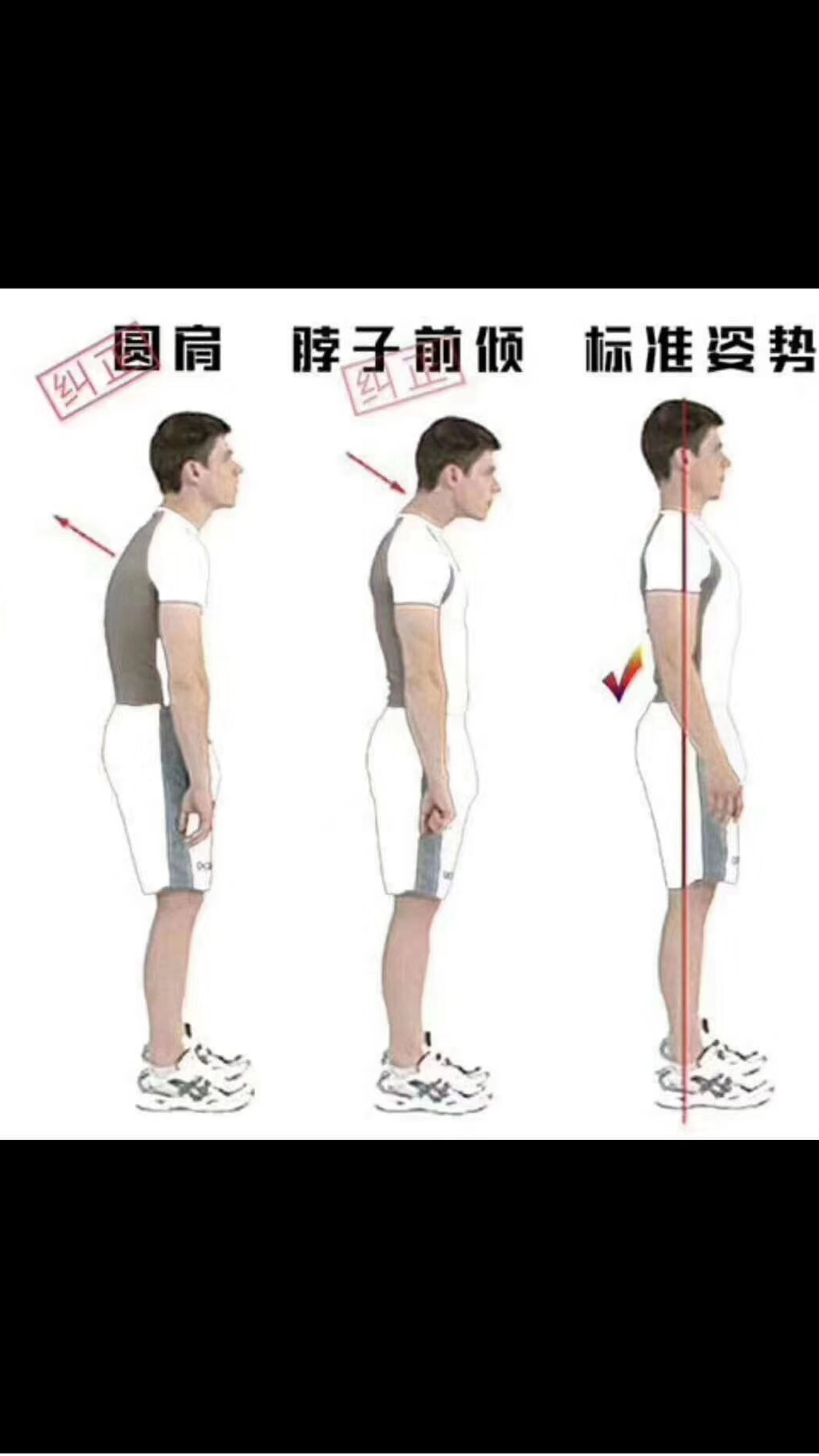 圆肩驼背怎么办？六个动作，每天坚持10分钟，有效改善圆肩驼背 - 知乎