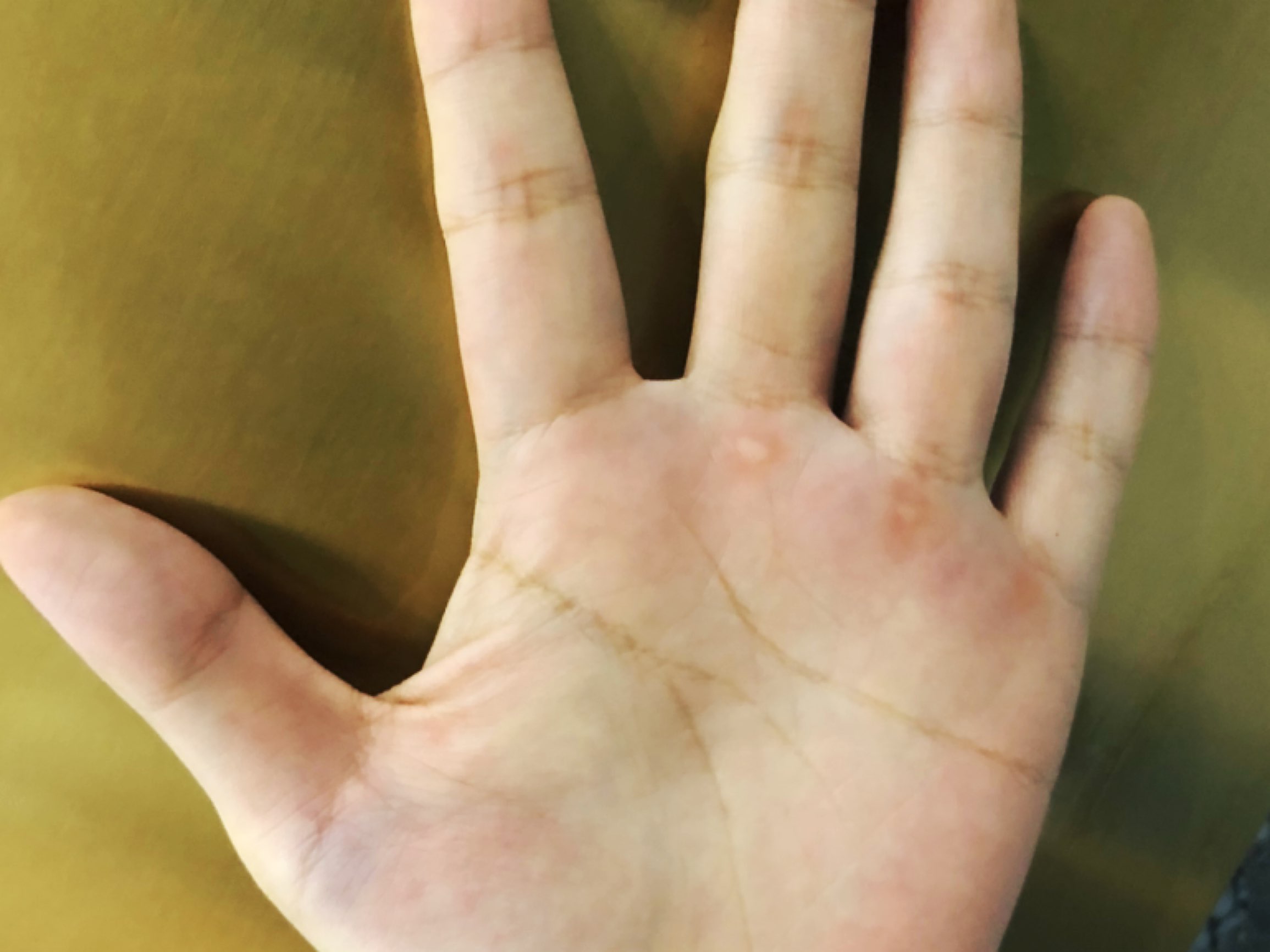 手上的茧子,其实看着感觉还挺好