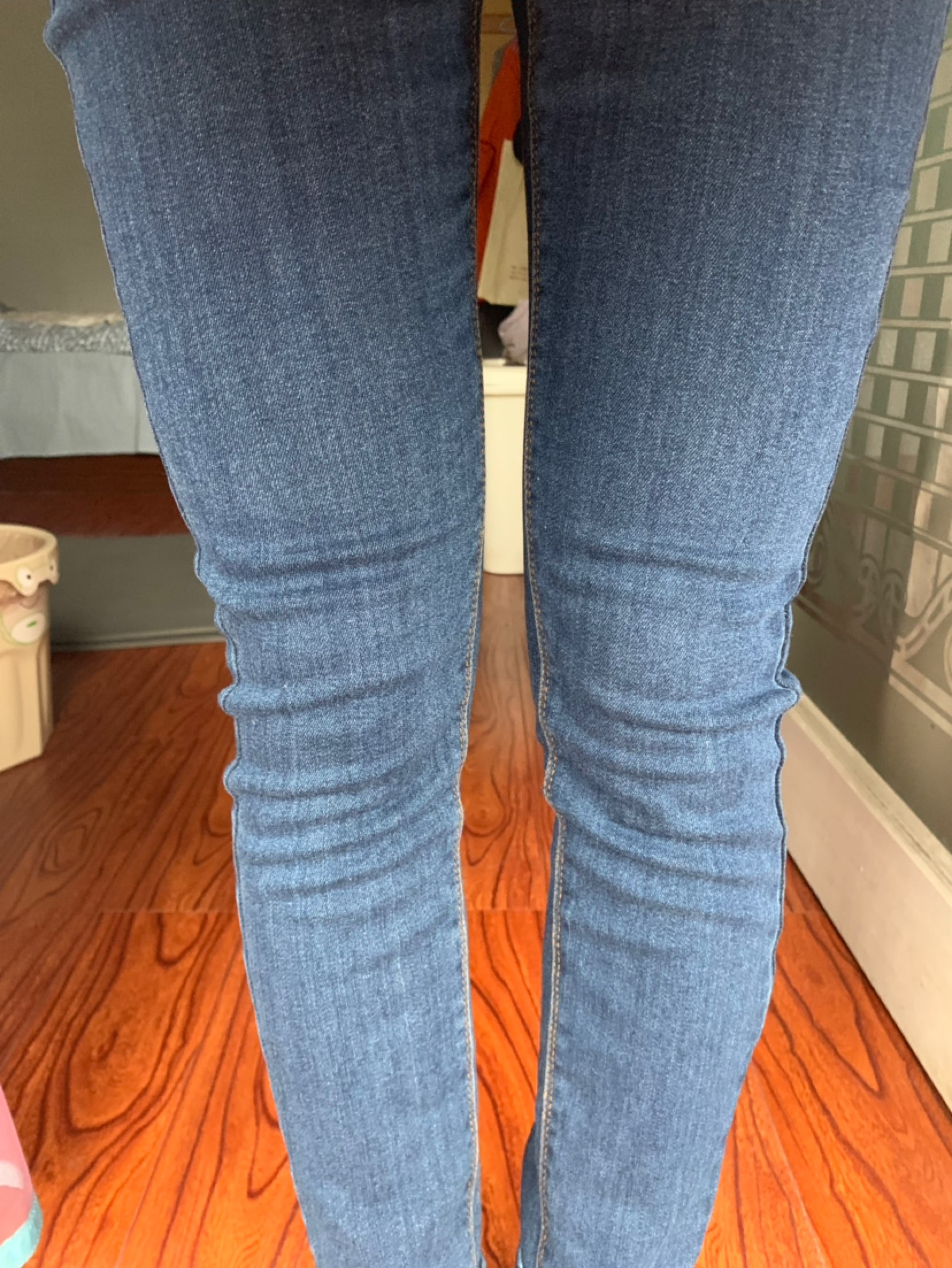 腿弯成这样,还有救吗?求推荐训练方法[流泪][流泪]