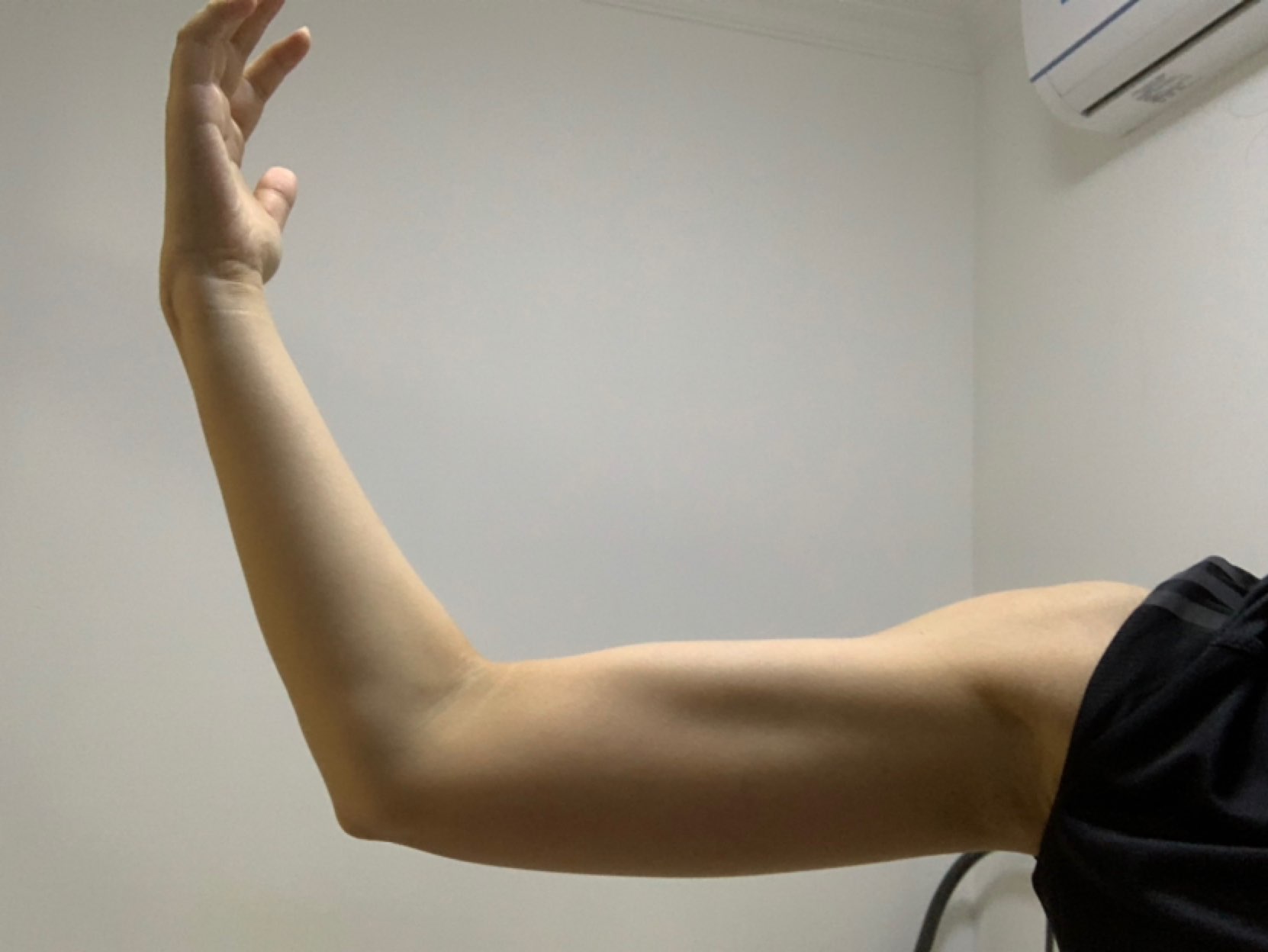 图一右臂,图二左臂.差别很大,背部肯定差距更大.