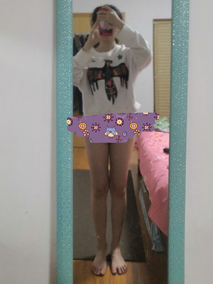 xo腿day17 图一自然站立图二膝踝并拢