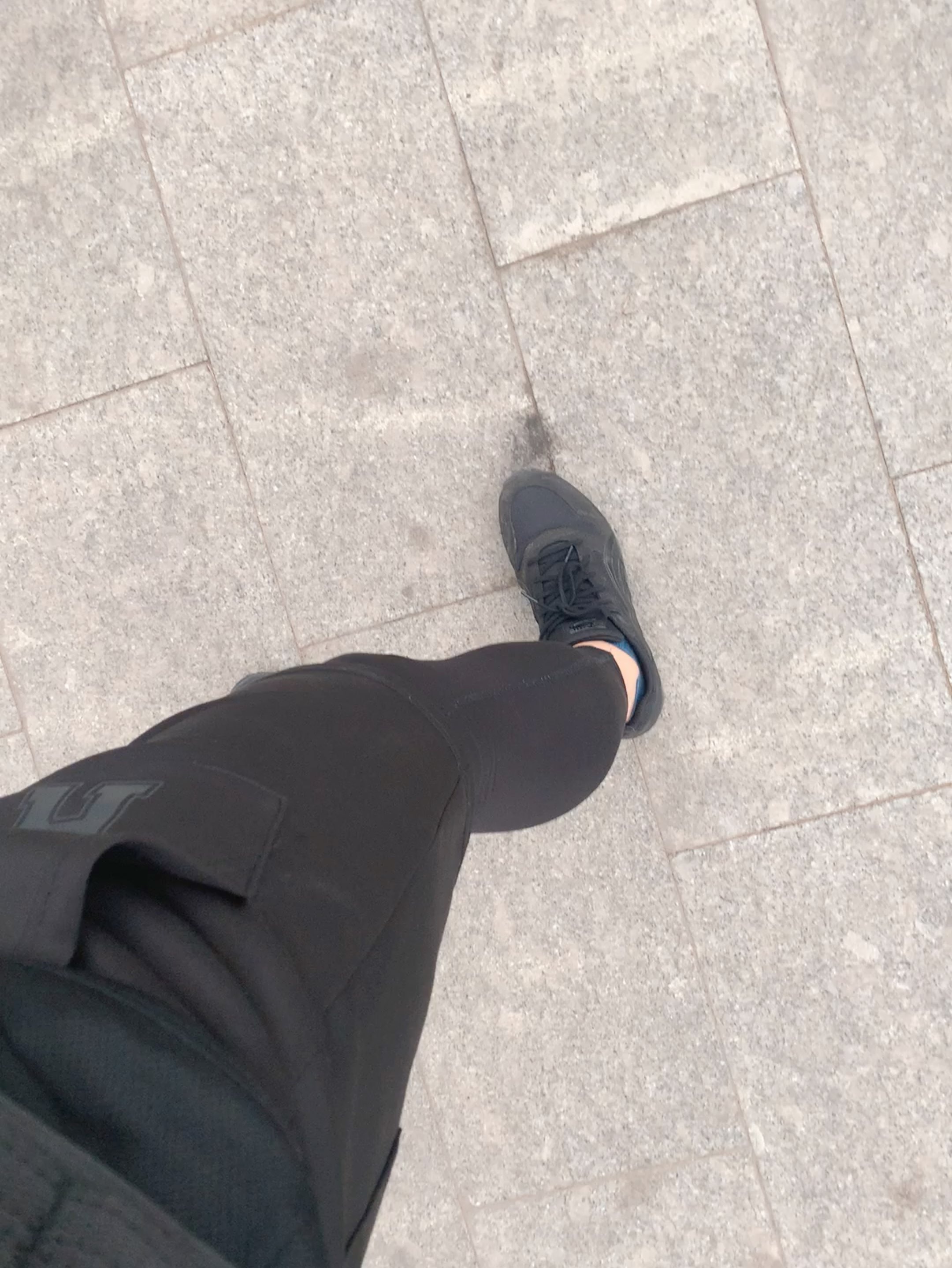 我的腿肚子为啥比别人肉大?疼死我了