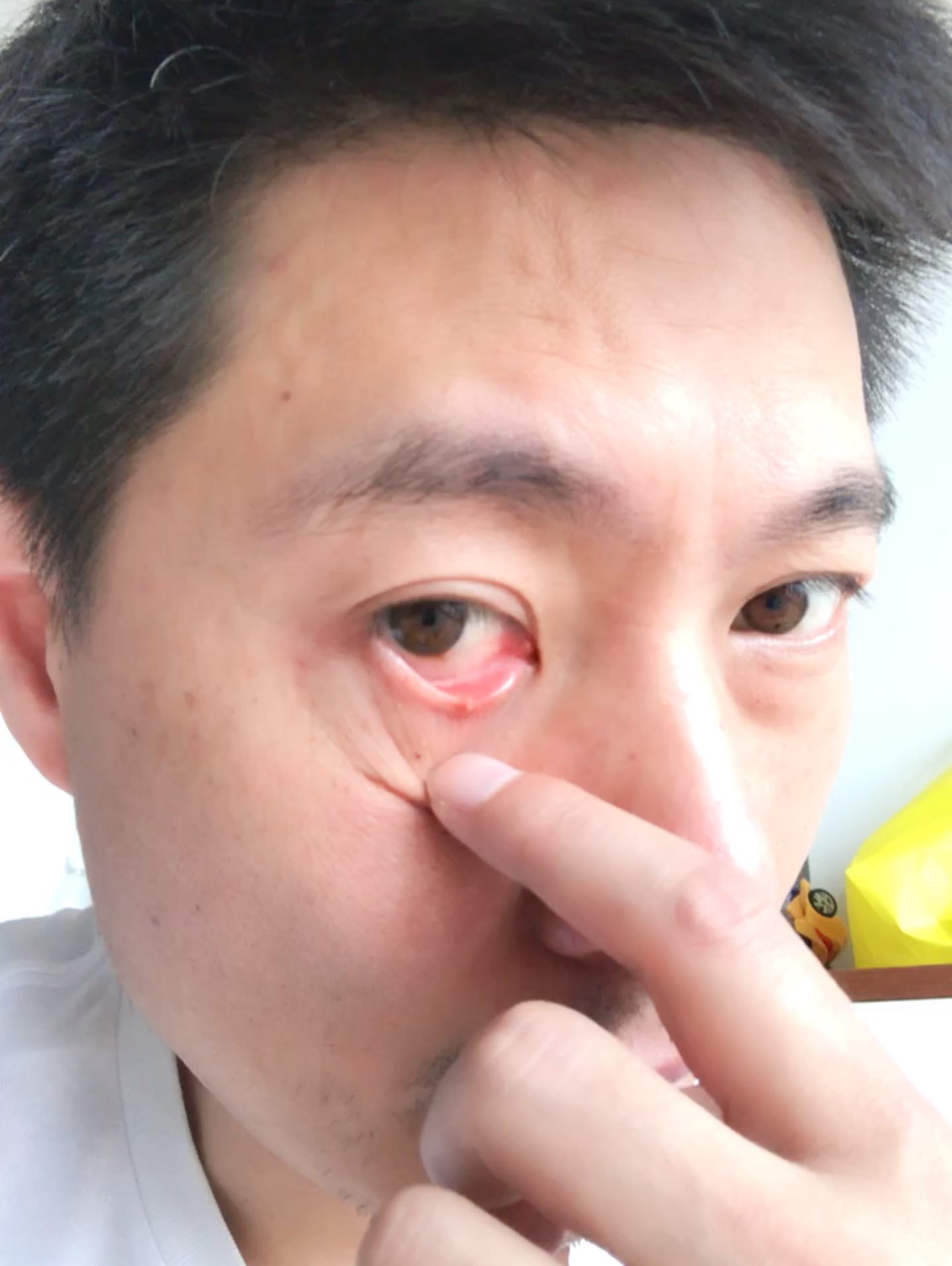 完成 徒手胸肌训练入门 第18次 眼睛昨天去医院小小外科手术 康复中