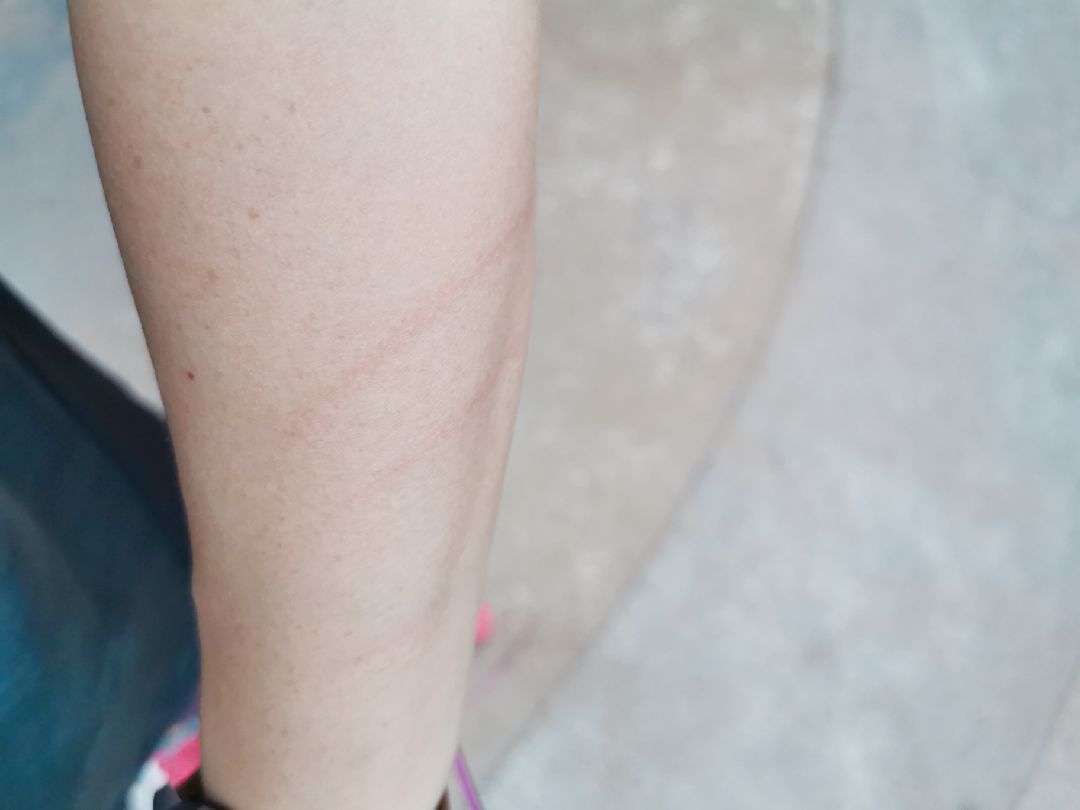 跳绳将近一年,仍会被绳抽