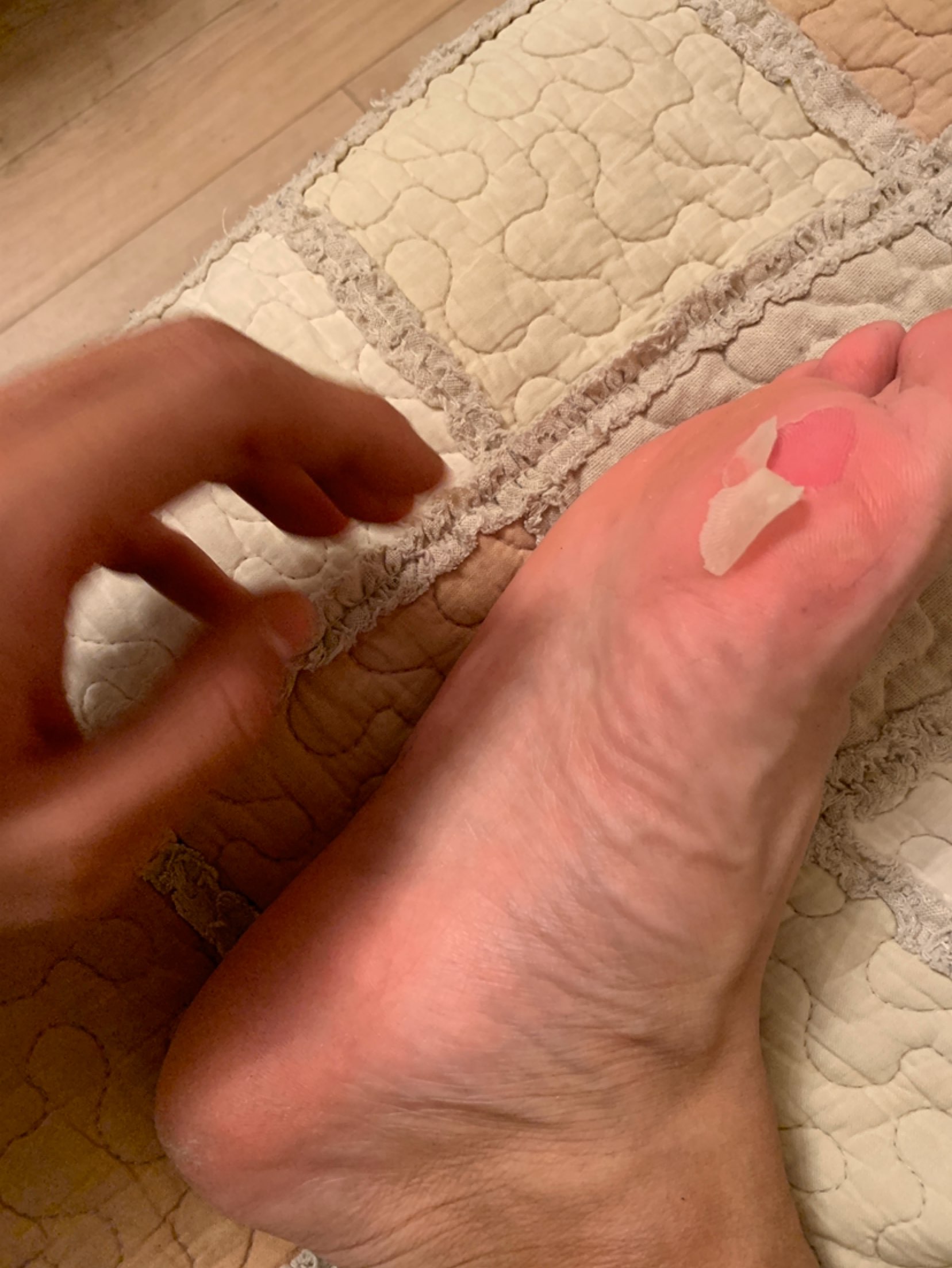 新买了件球衣,凹了个造型去打球,一激动忘了带袜子和鞋了,结果脚废了