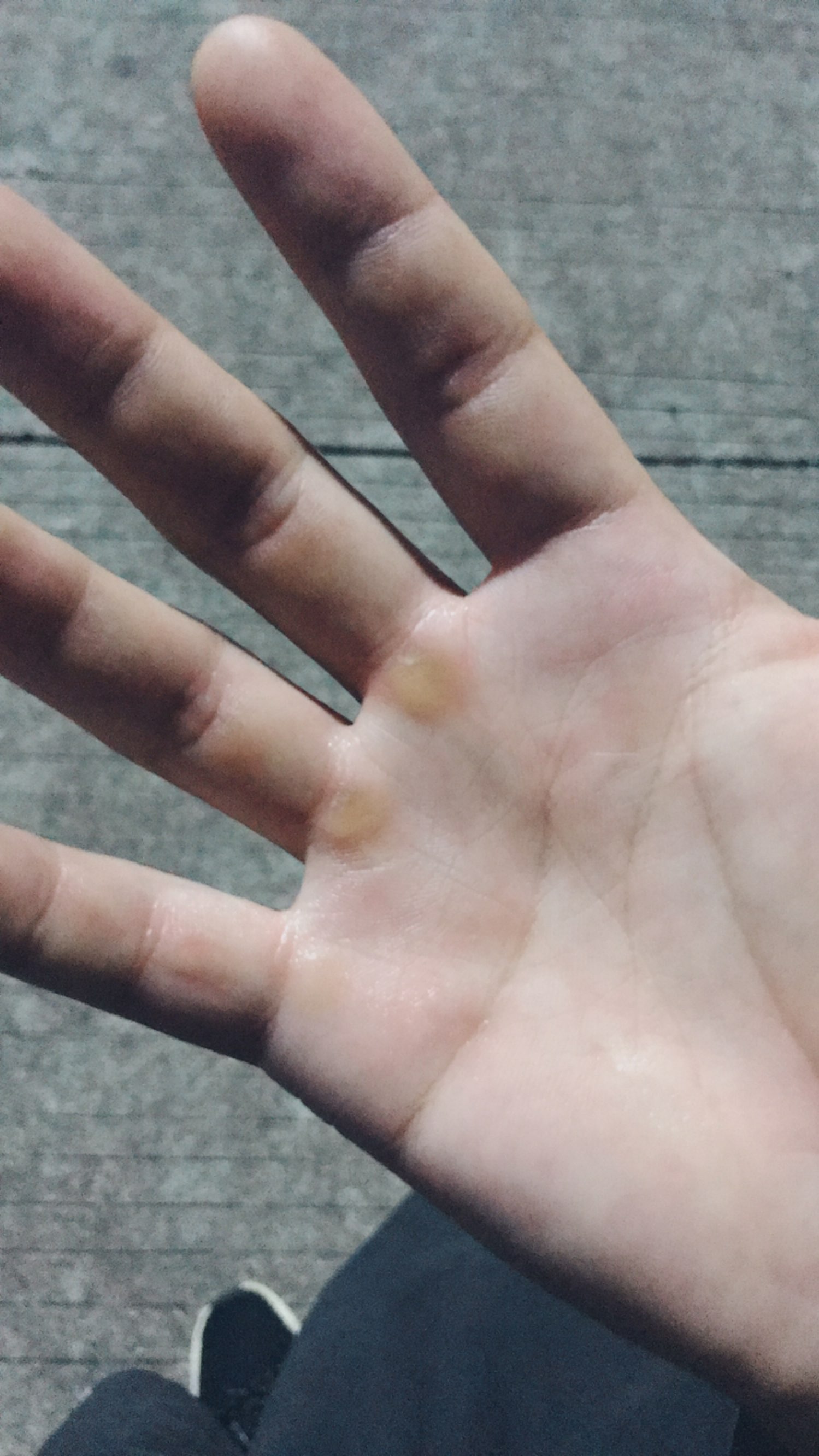 我这布满老茧的纤纤玉指呀,为了胸肌拼了,大老爷们手上没点老茧,没点