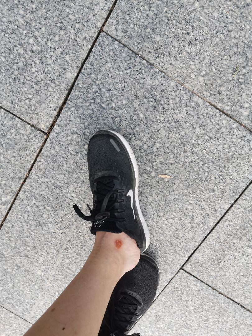 昨天滑滑板没玩好直接把脚蹭破了,今天跑起来不觉得疼,跑完就不是回事