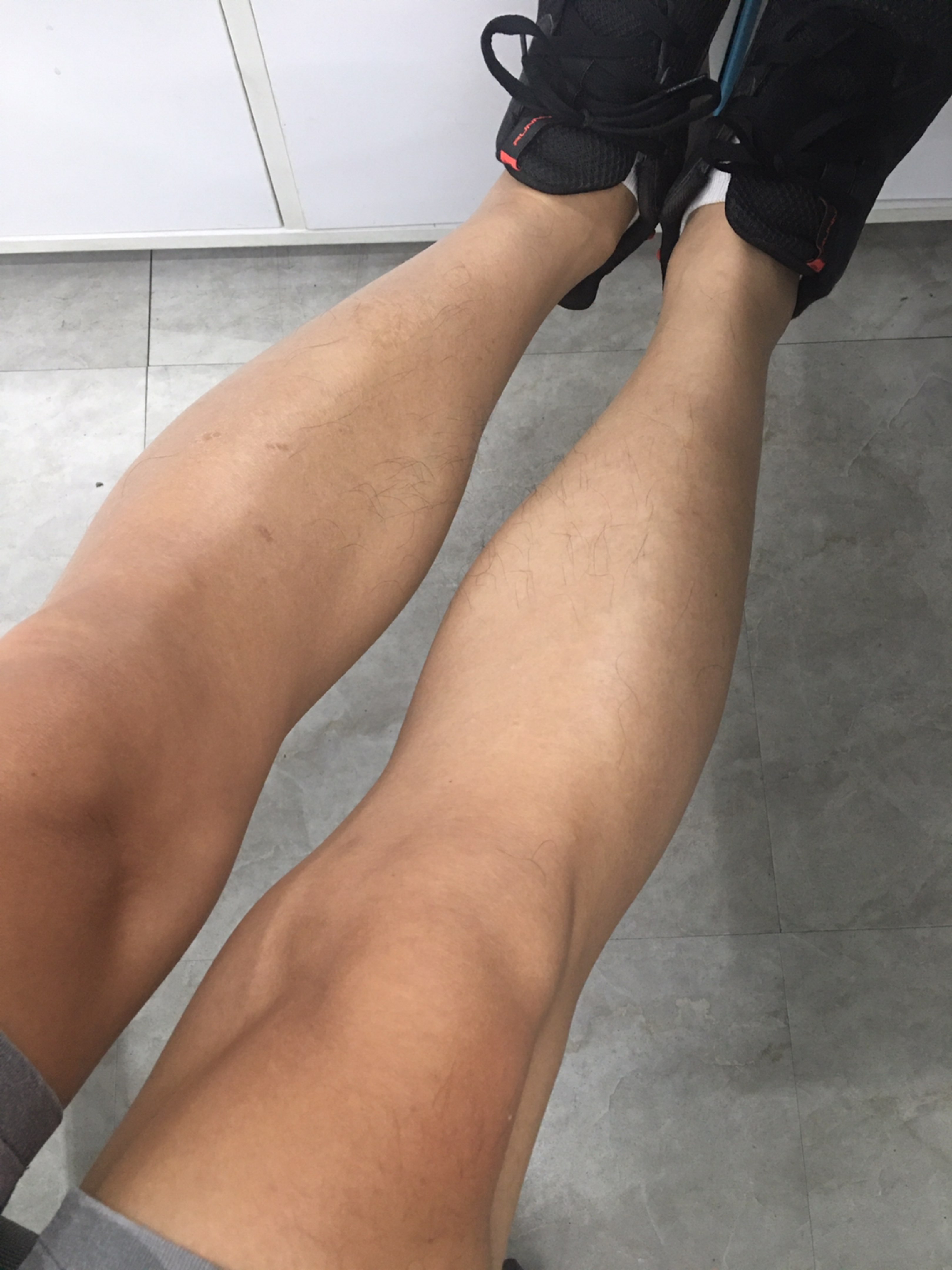 脚晒黑了[苦笑]