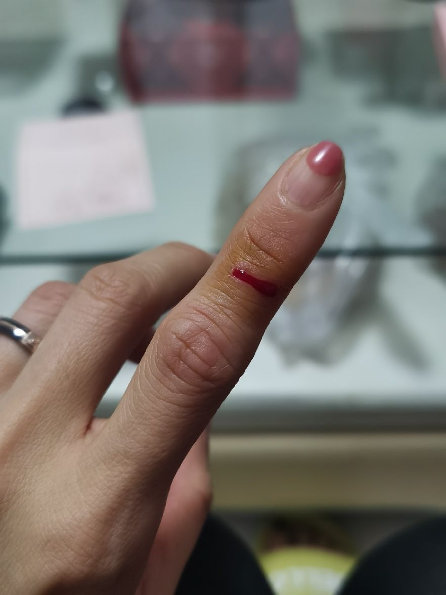 换了5个创可贴,浸透了2个,到家小心翼翼地换药却还是把伤口撕裂了!