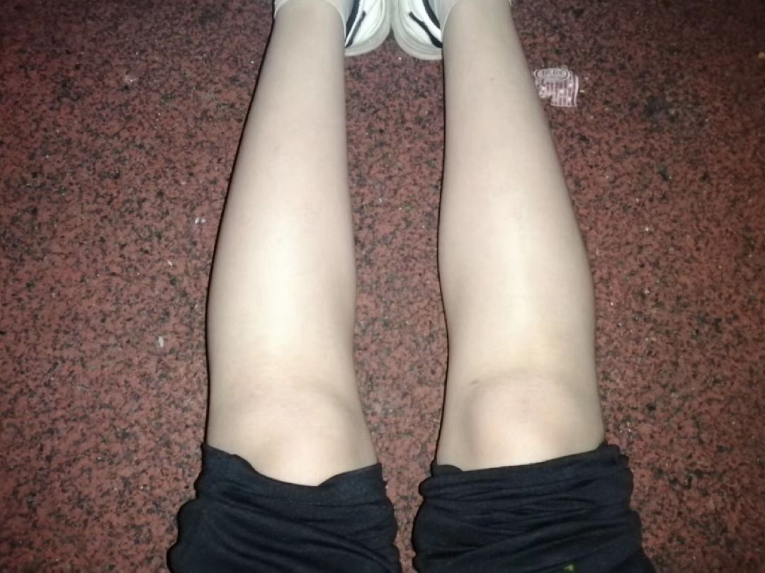 前面是运动17天的小腿图后面两张是今天的图感觉好像没有什么变化呀就