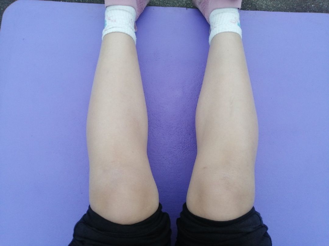 前面是运动17天的小腿图后面两张是今天的图感觉好像没有什么变化呀就