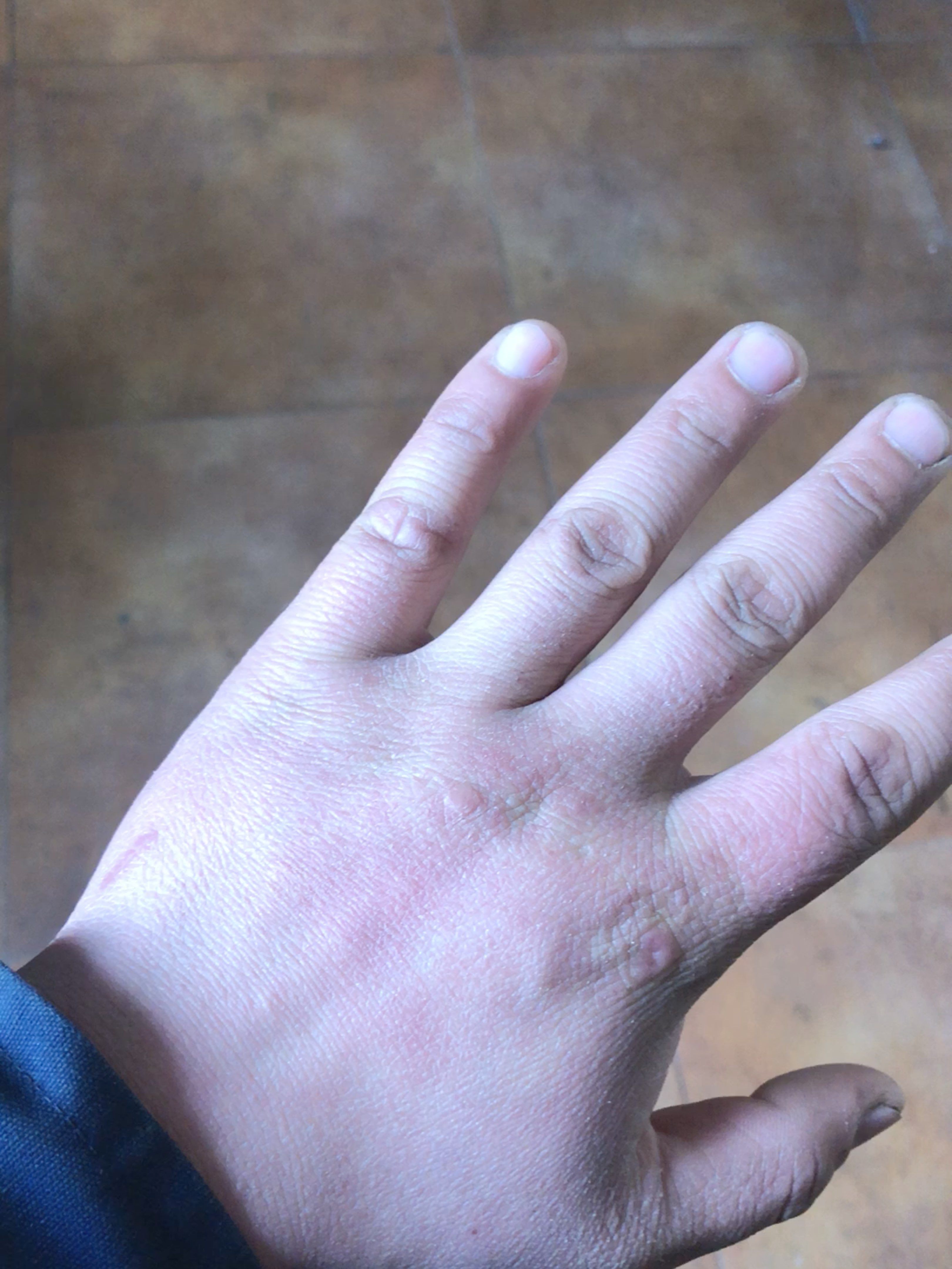 我的胖手改怎么去减